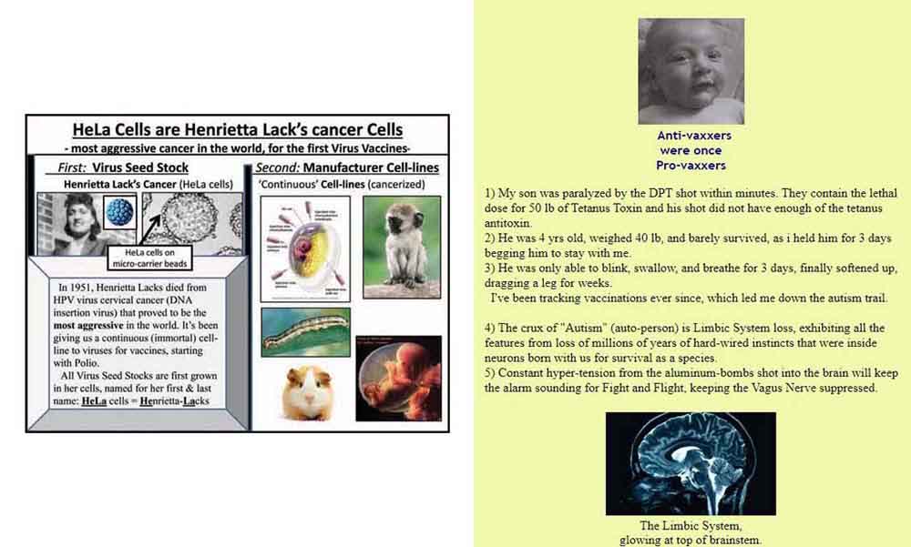 Alison Jones Vaccine Tracker Site Image